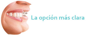 Mejor ortodoncia invisible en Málaga