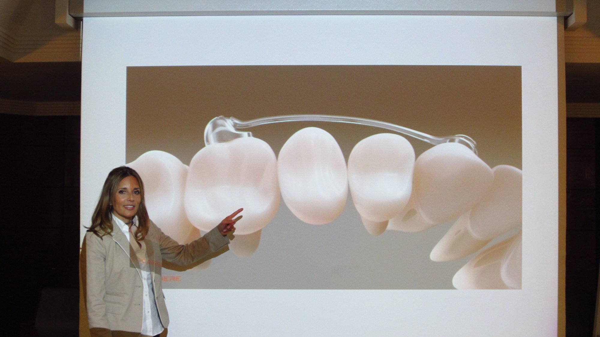La Dra. Ana María Cantor de Odontokids presentó la sesión clínica de 'Simplificación del tratamiento ortodóncico en clase II y clase III' con el dispositivo Motion en el Colegio de Dentistas de Málaga. (Abril de 2018)